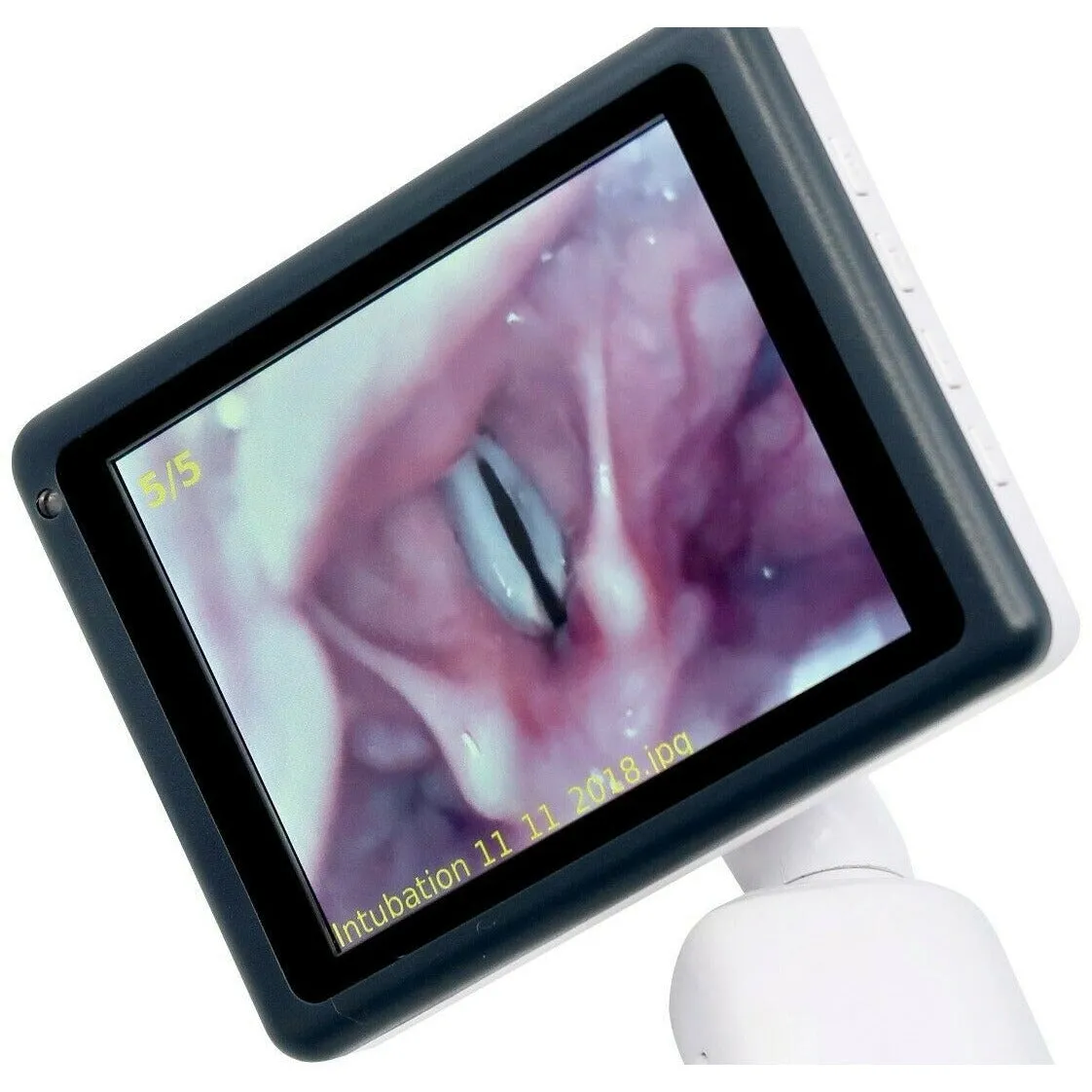 CapnoVision Pro Video Laryngoscope Kit