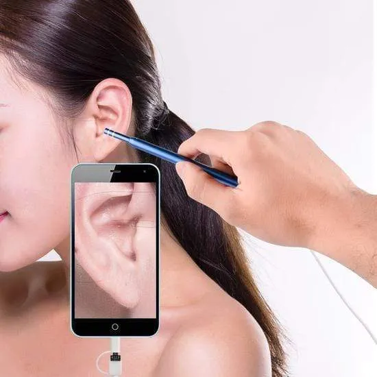 Ear Clean Endoscope 1.3 MP Camera