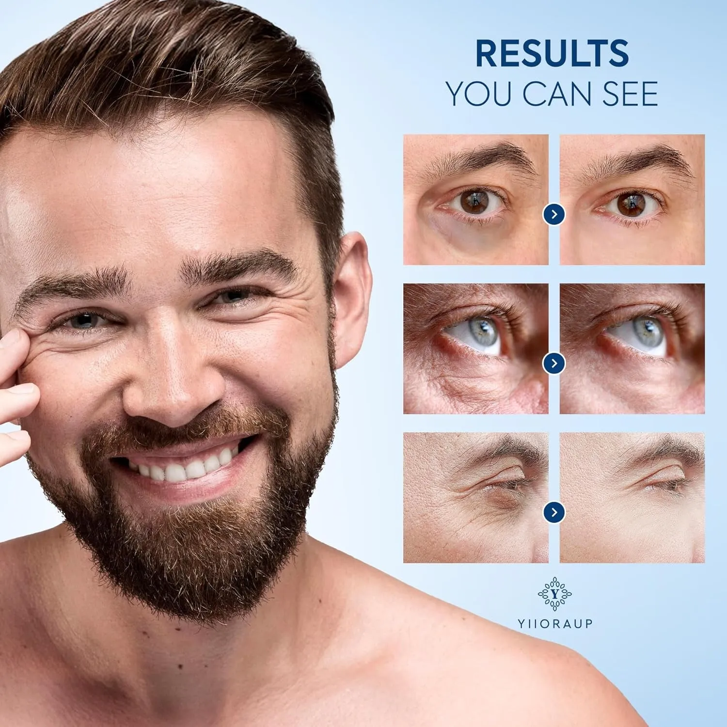 Eye Bags Treatment for Men: Eye Roller for Puffy Eyes and under Eye Puffiness Reducer – Caffeine Eye Cream for Dark Circles and Wrinkles