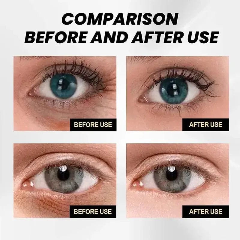 Retinol Anti-Puffiness Eye Cream