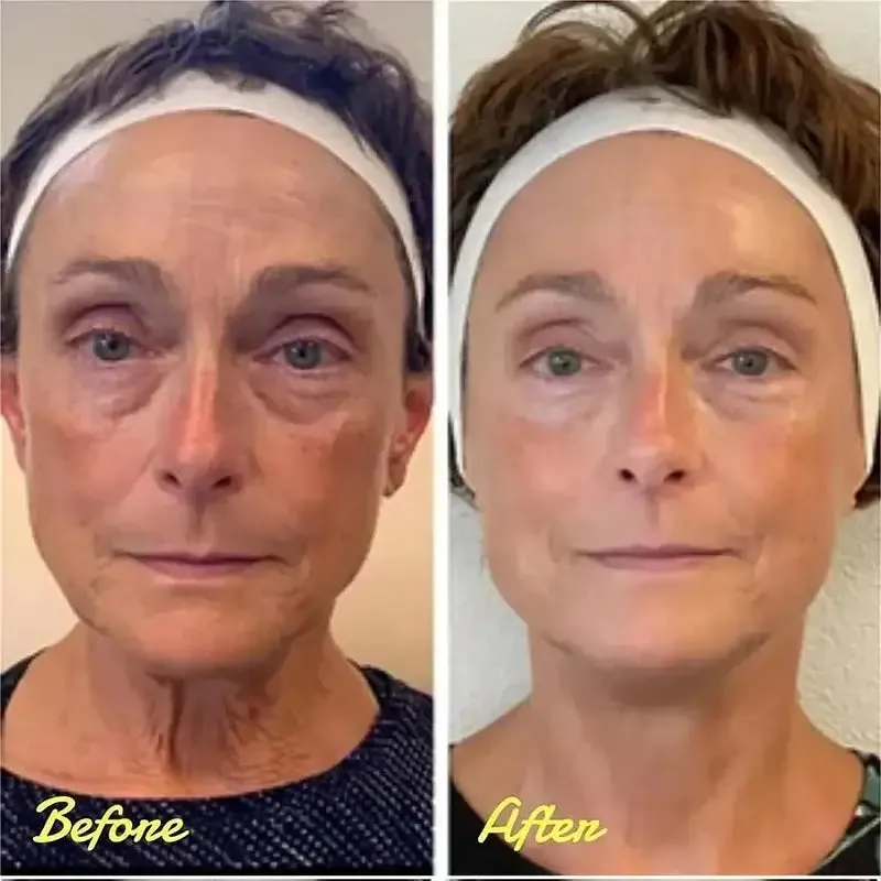 Retinol Anti-Puffiness Eye Cream